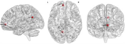 Altered Effective Connectivity in the Default Network of the Brains of First-Episode, Drug-Naïve Schizophrenia Patients With Auditory Verbal Hallucinations
